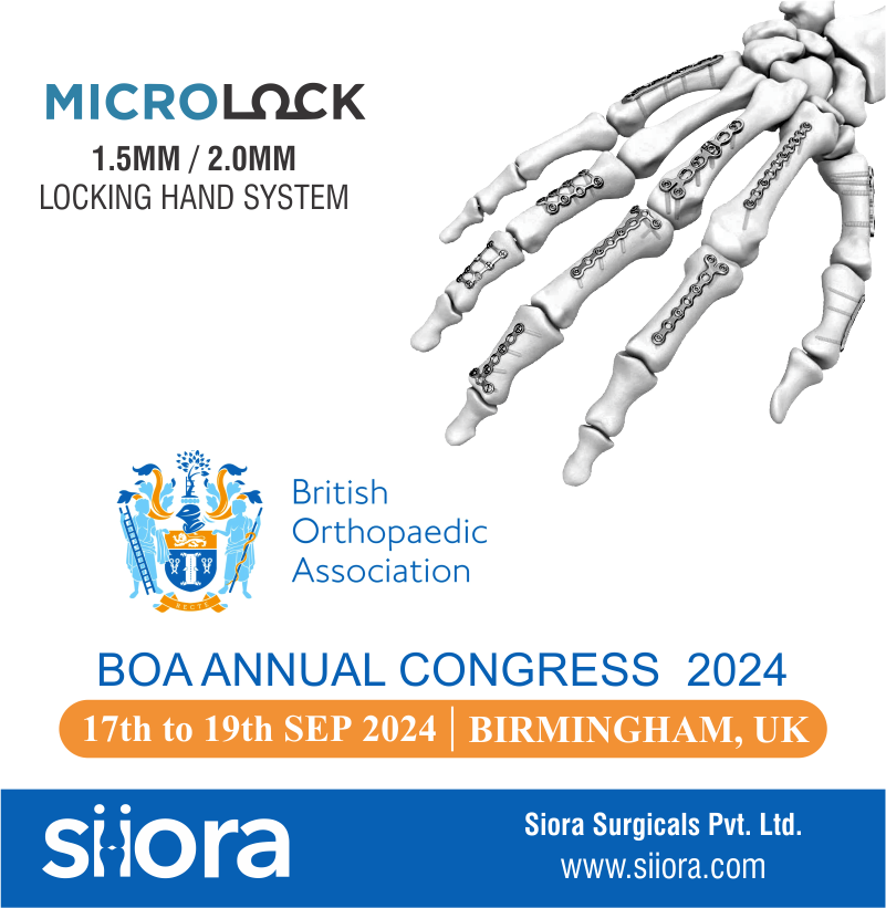 BOA Annual Congress in UK – A Must-Visit Orthopedic Even